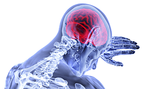 Novel Imaging Techniques to provide Optimal Treatment for Stroke Patients